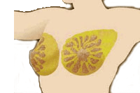 breast cancer type